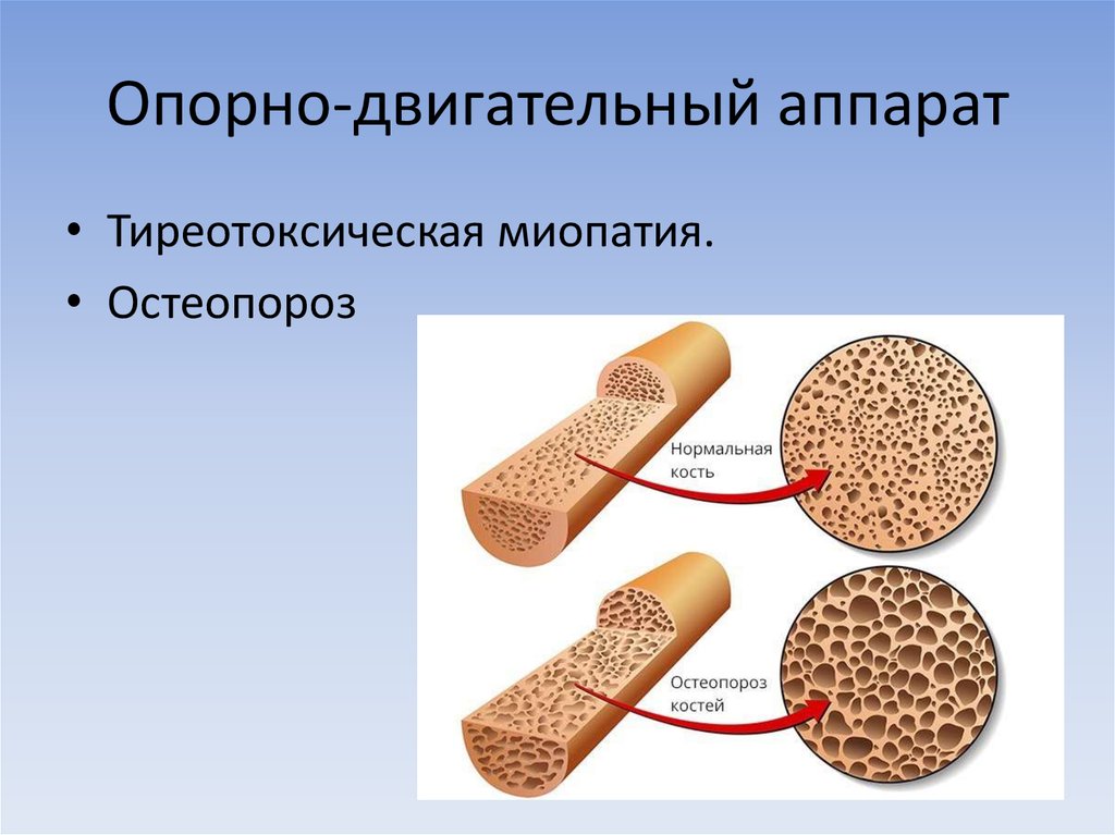 Опорно-двигательный аппарат