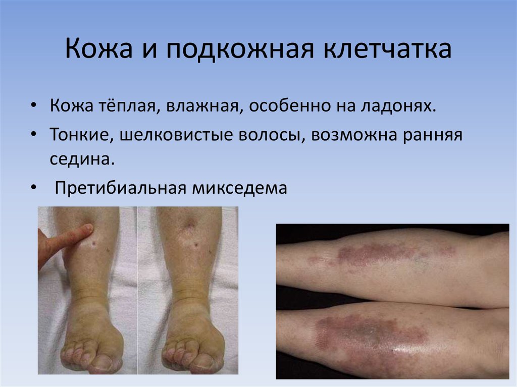 Кожа и подкожная клетчатка