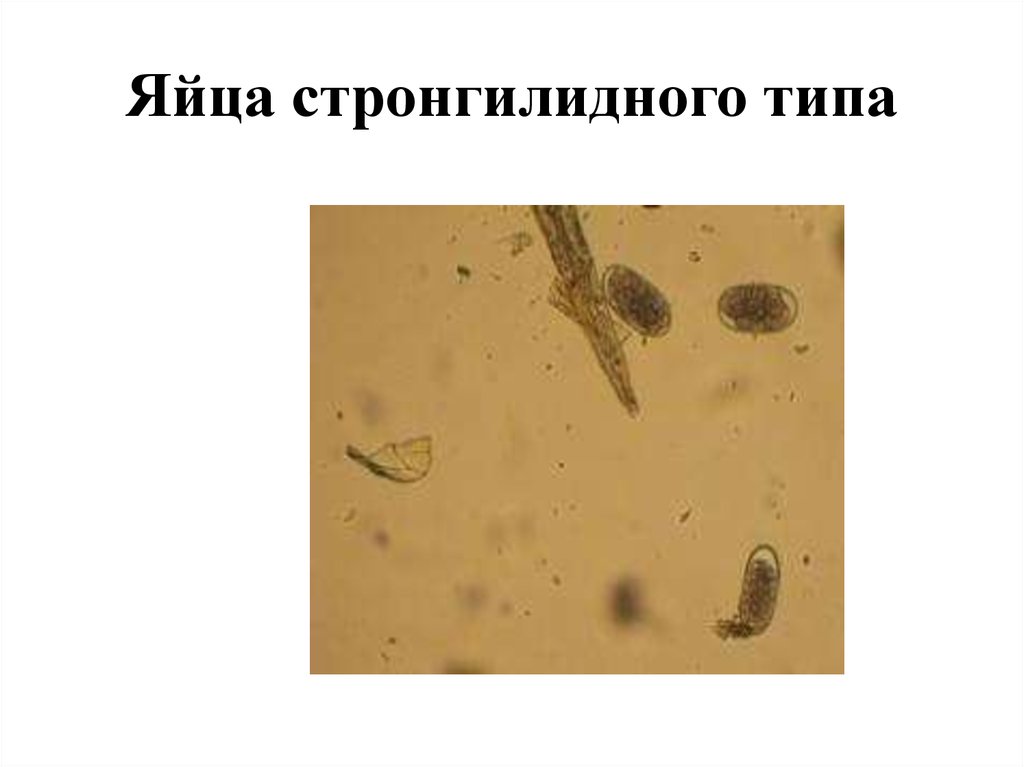 Стронгилоидоз лошадей. Стронгилоидоз лошадей яйца. Яйца стронгилидного типа. Яица стронгилятозного типа. Личинки стронгилидного типа.
