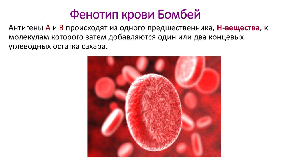 Фенотип крови Бомбей