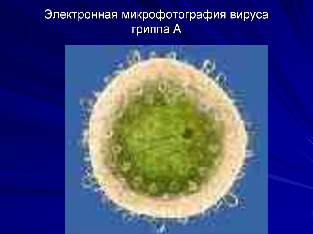 Вирус гриппа группа. Вирус парагриппа микрофотография. Электронная микрофотография вируса гриппа а. Вирус гриппа микрофотография. Вирус парагриппа под микроскопом.