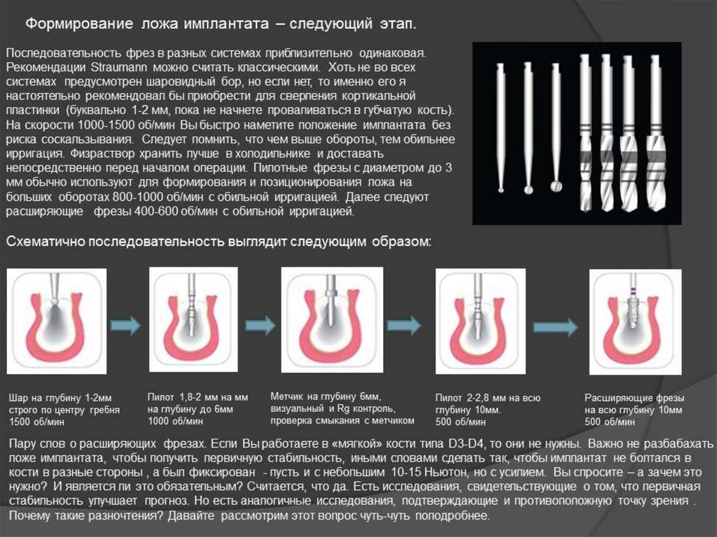 Хирургический инструментарий и медикаментозное сопровождение дентальной имплантации презентация