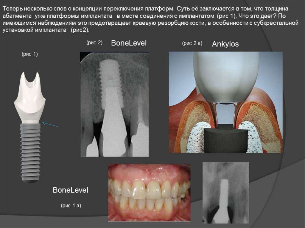 Анатомические предпосылки стоматологической имплантации презентация