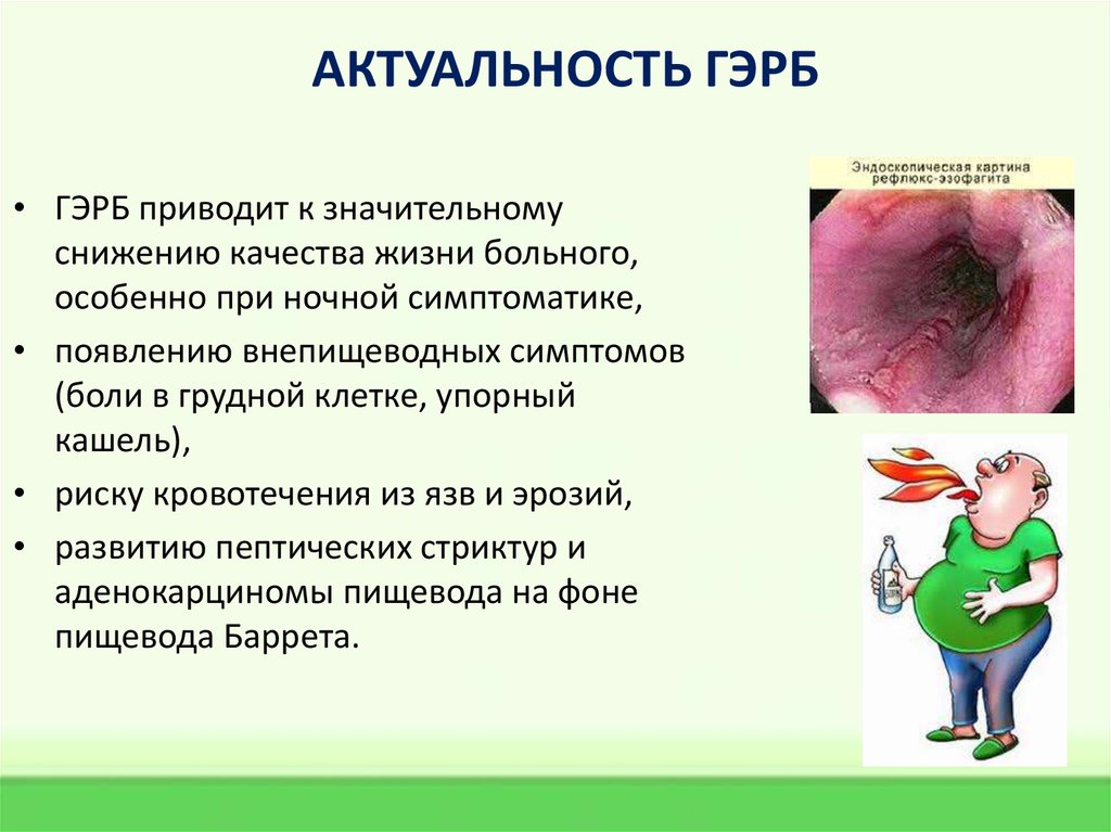 АКТУАЛЬНОСТЬ ГЭРБ