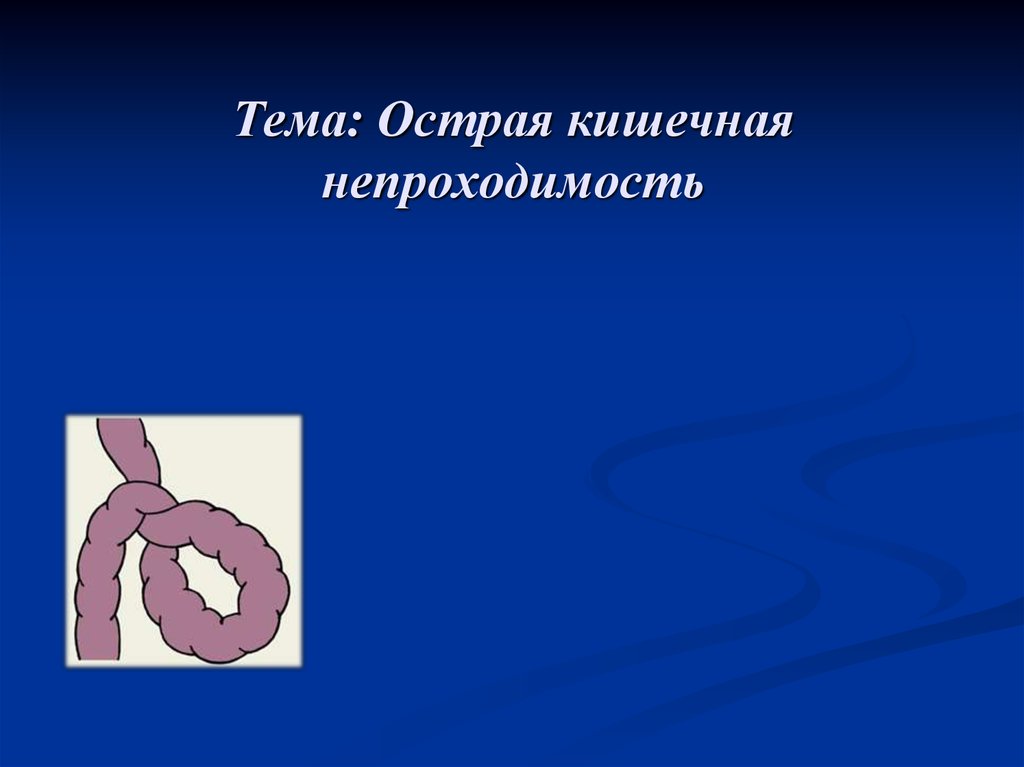 Острая кишечная непроходимость. Госпитальная хирургия кишечная непроходимость. Острая кишечная непроходимость хирургия. Острая толстокишечная непроходимость.