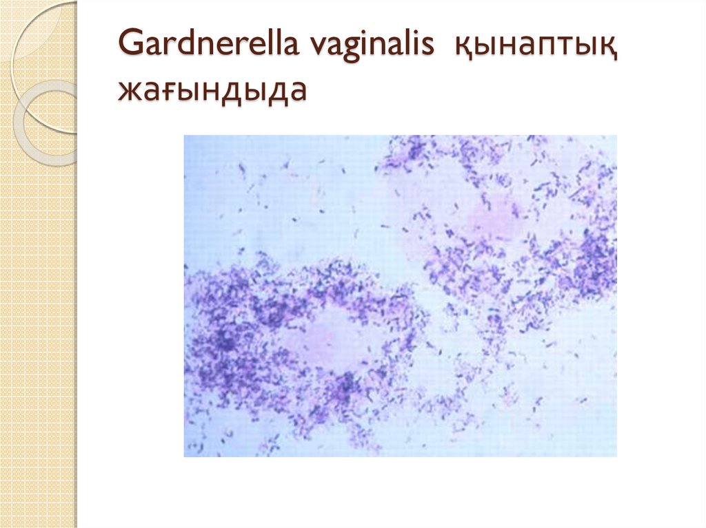 Gardnerella vaginalis қынаптық жағындыда.