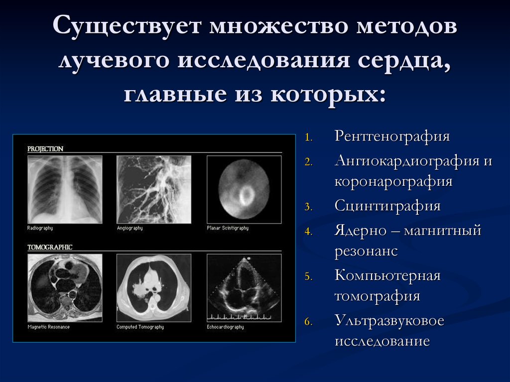 Лучевая диагностика сердечно сосудистой системы презентация