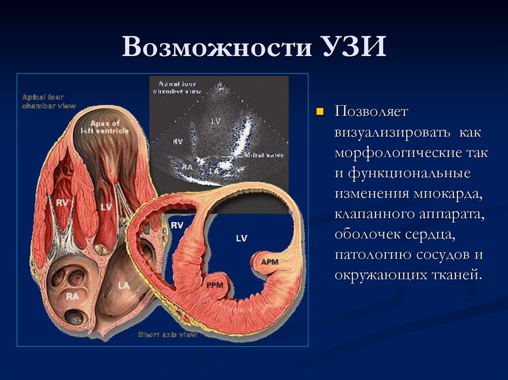 Узи сердца презентация