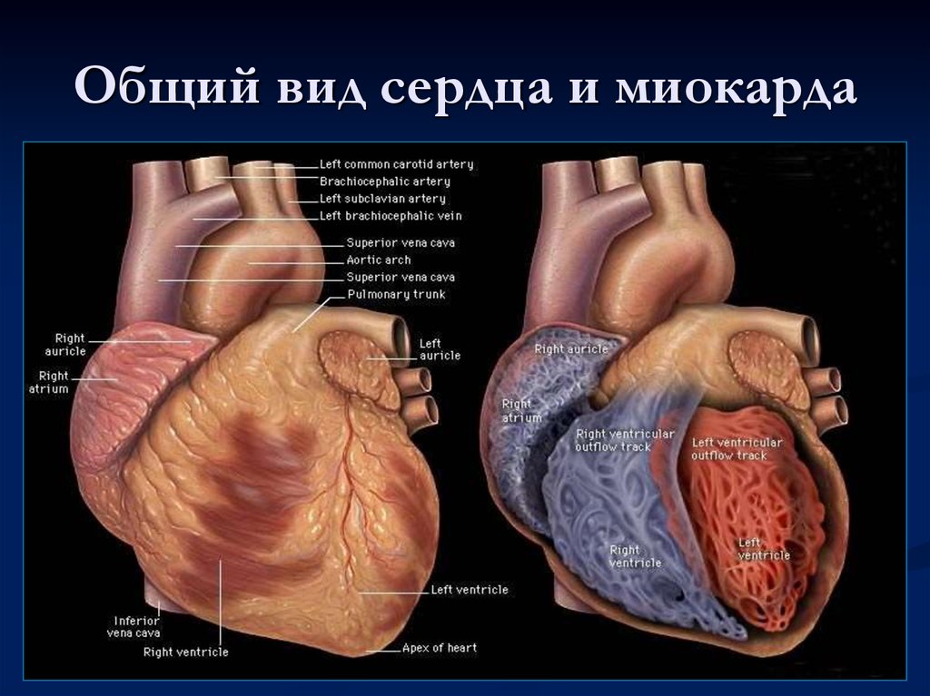 Сердечный миокард. Сердце общий вид. Расположение миокарда. Лучевая анатомия сердца.