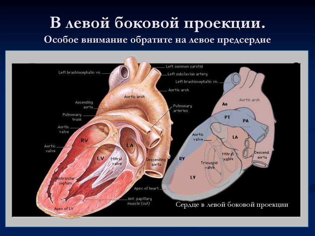 Правое предсердие является. Левое предсердие. Предсердия сердца. Левое предсердие сердца. Лучевая анатомия сердца.