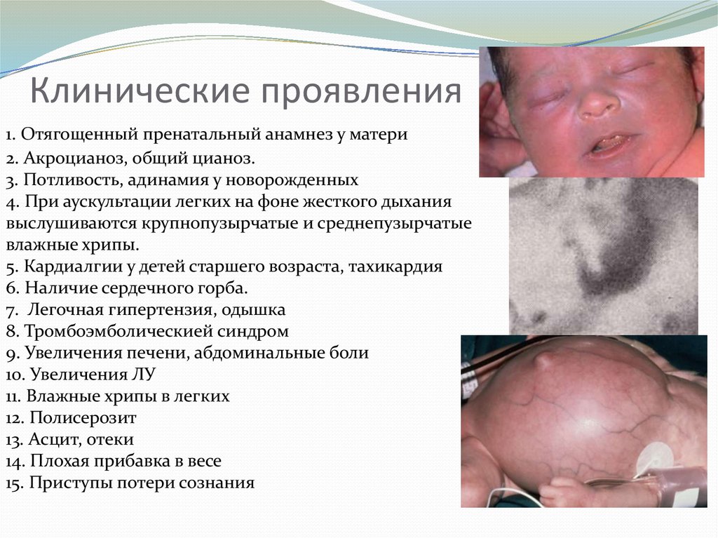 Клинические проявления