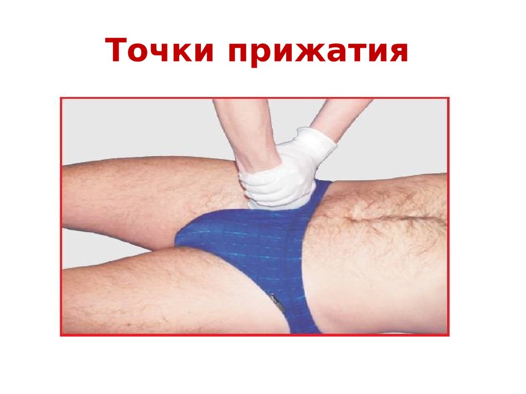 Точки прижатия