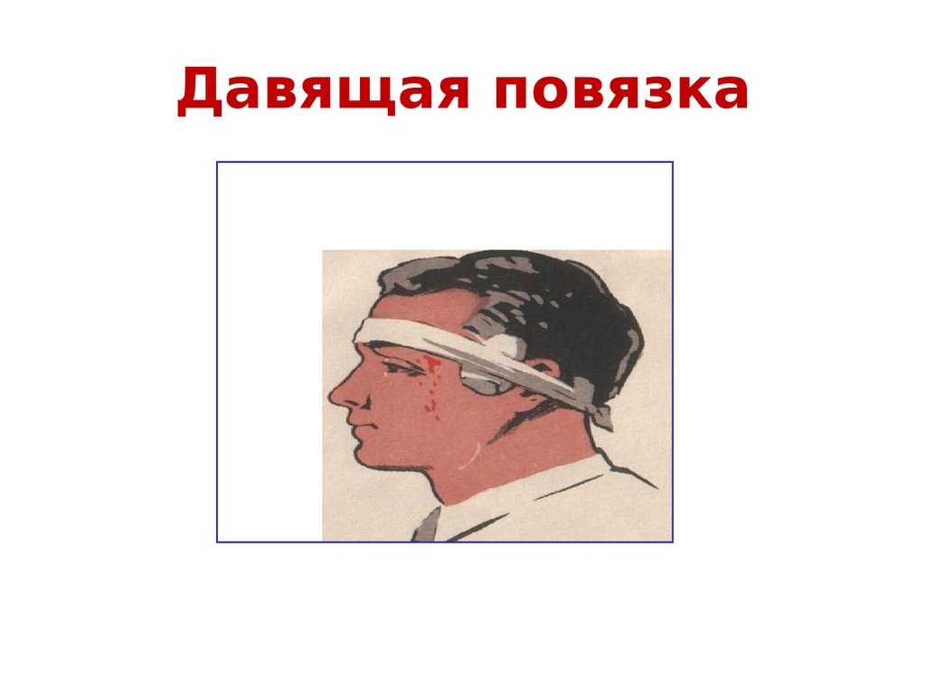 Рассмотрите рисунки 1 3 на которых изображены виды наружного кровотечения у человека