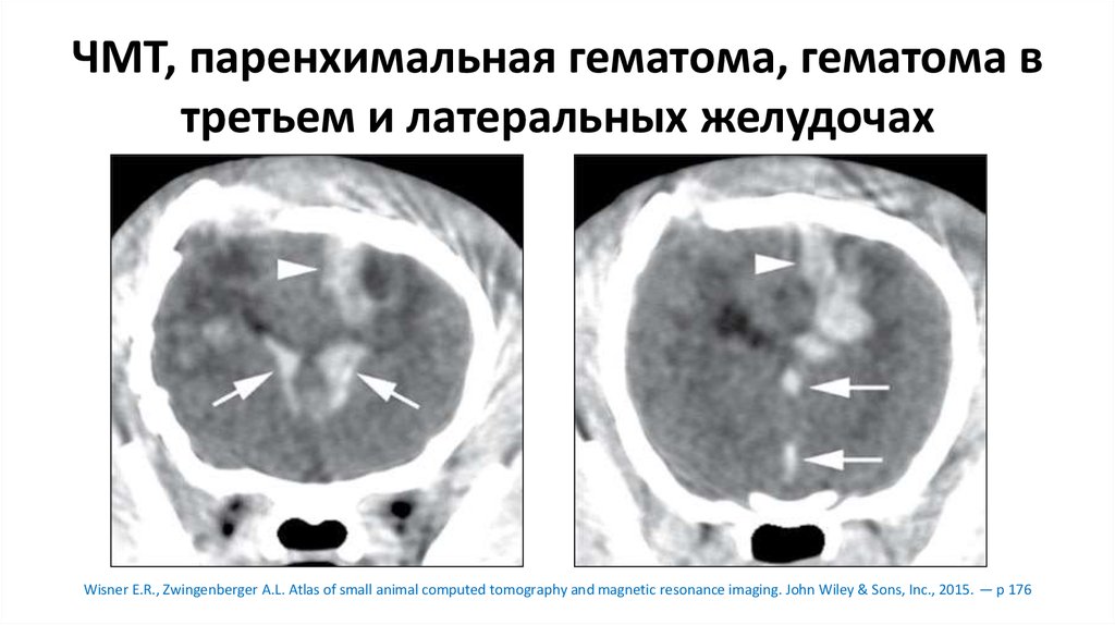 Давность гематом