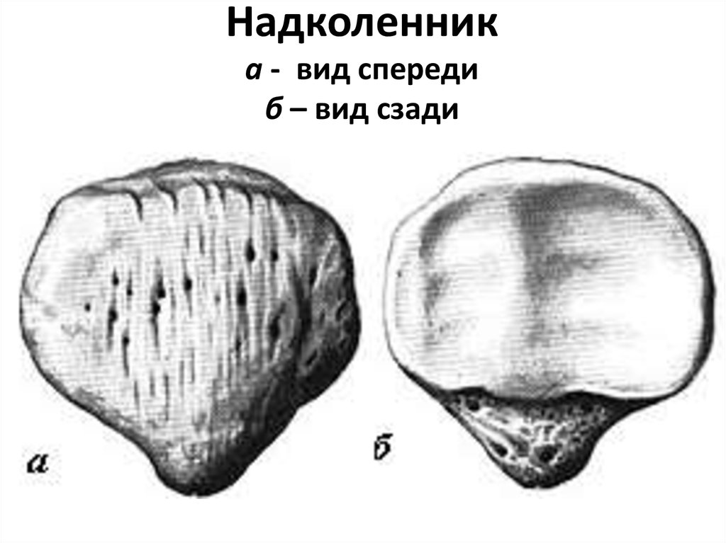 Латеральная фасетка