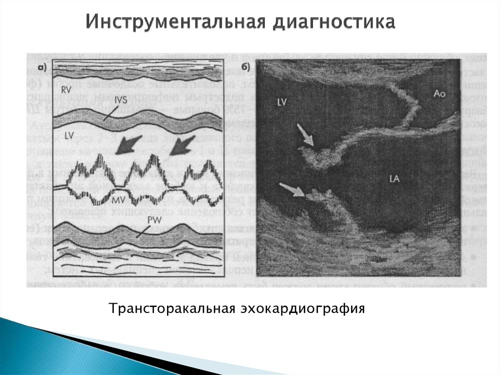 Инструментальная диагностика