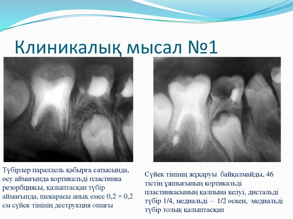 Клиникалық мысал №1