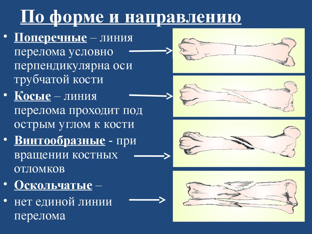 Могут ли у человека болеть кости