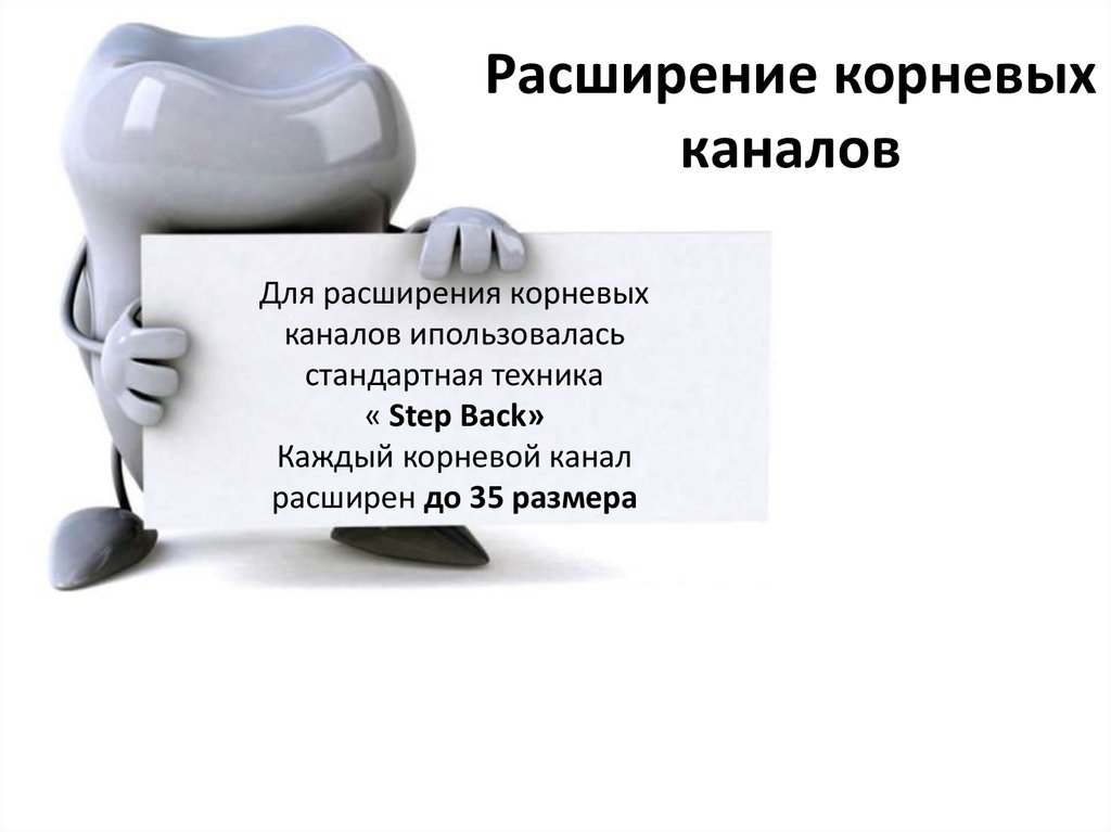 Для расширения корневых каналов ипользовалась стандартная техника « Step Back» Каждый корневой канал расширен до 35 размера