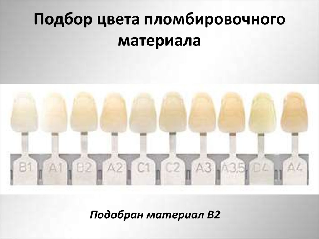 Подбор цвета пломбировочного материала