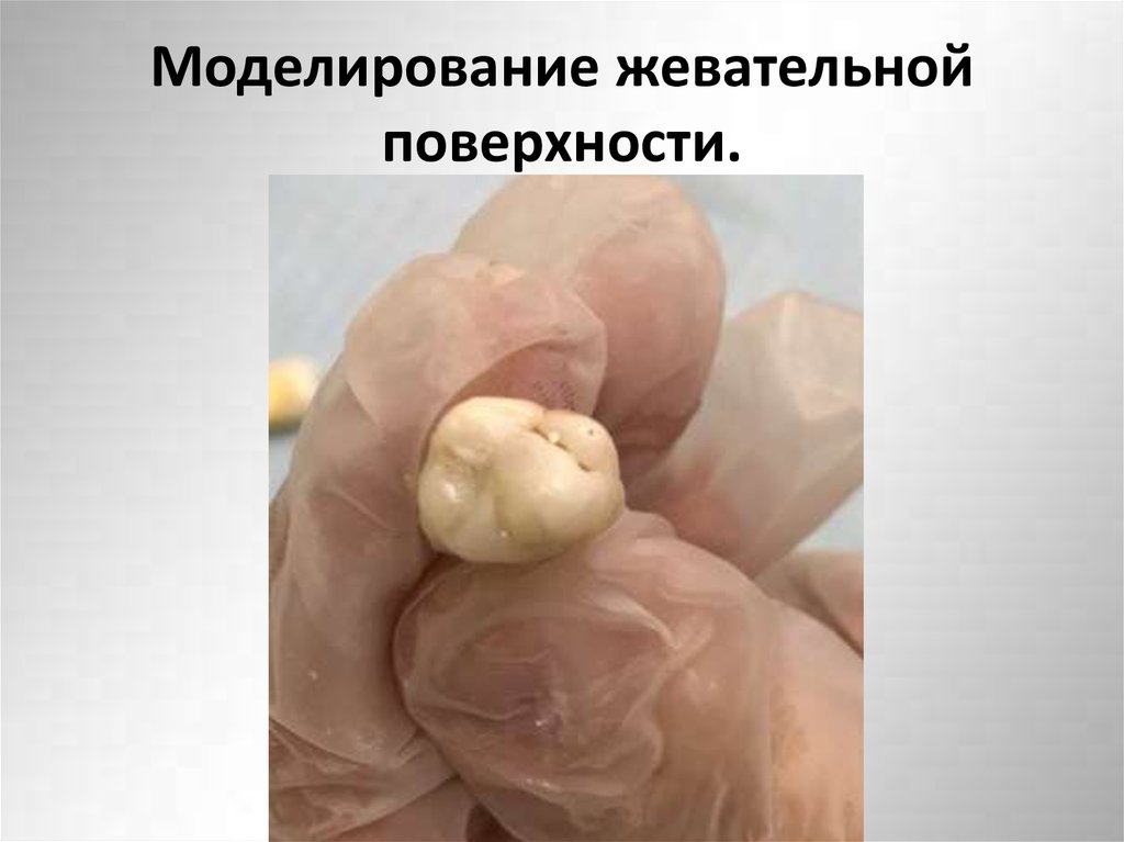 Моделирование жевательной поверхности.