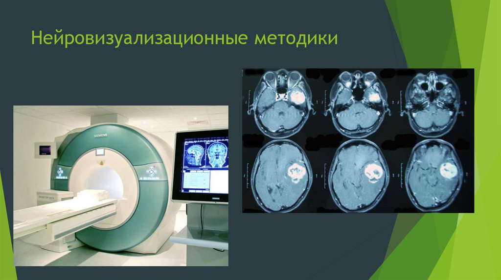 Нейровизуализационные методики