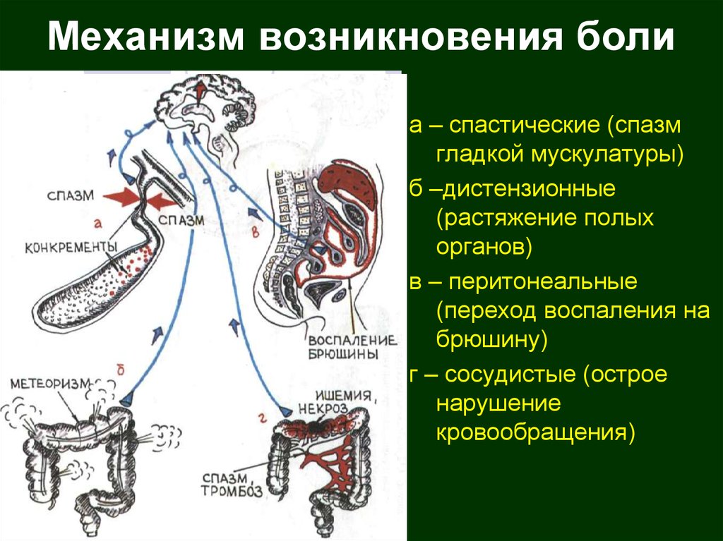 Основные механизмы боли схема