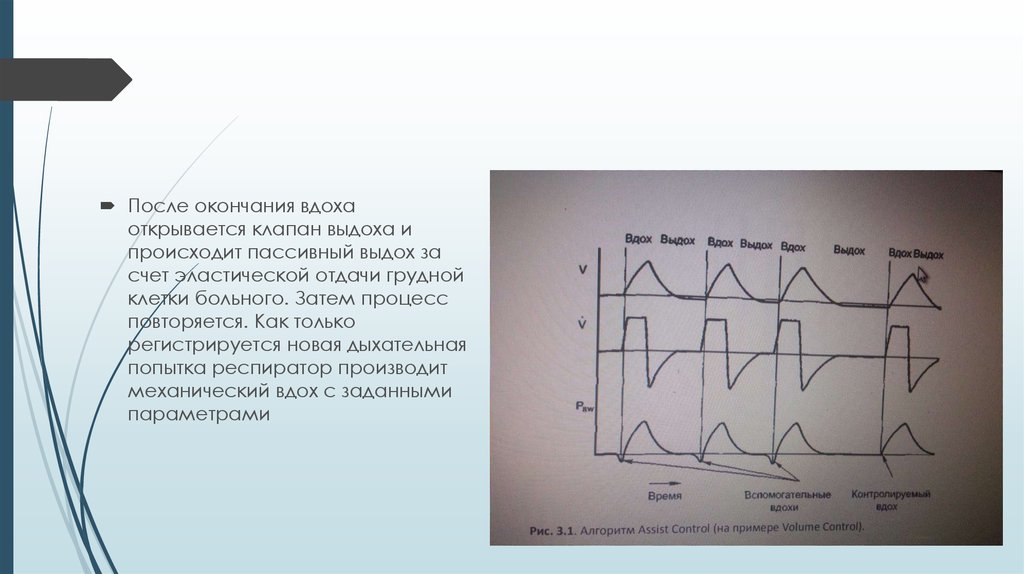 Клапан вдоха и выдоха ИВЛ. Пассивный выдох. Вдох активный процесс выдох пассивный. Пассивный выдох обеспечивается.