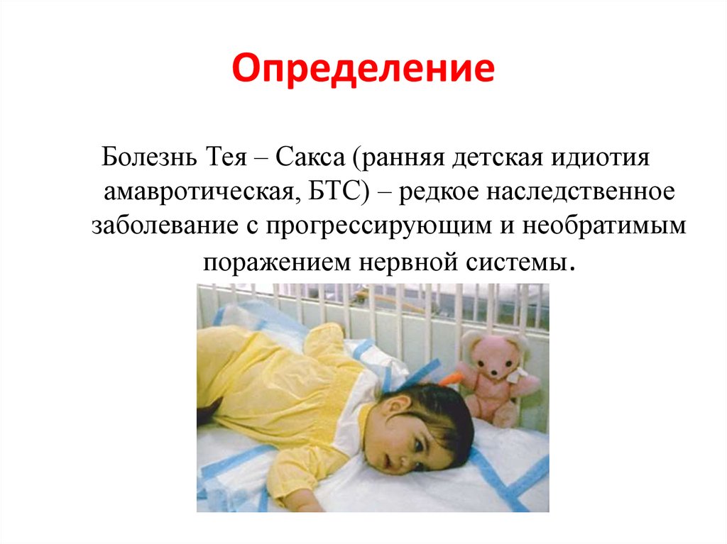 Презентация синдром тея сакса