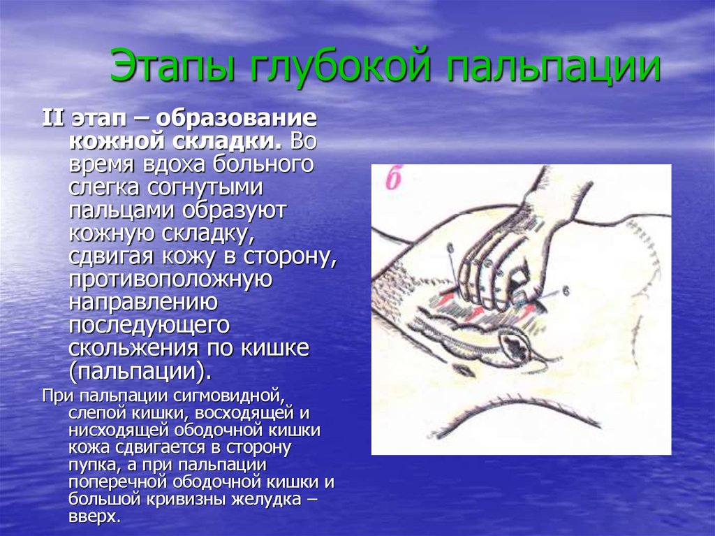 Глубокая пальпация. Этапы глубокой пальпации. При глубокой пальпации образование кожной складки. Этапы глубокой пальпации живота. Второй этап глубокой пальпации.