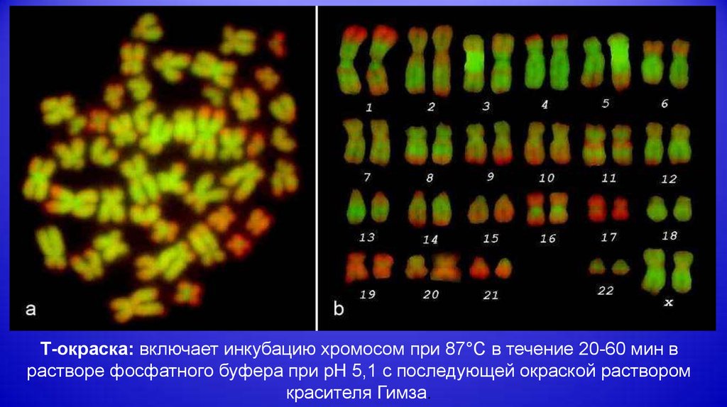 Хромосомный набор клеток мужчин. Методы дифференциальной окраски хромосом. Метод дифференциальной окраски хромосом. Методы дифференциального окрашивания хромосом. Методы дифференциального окрашивания хромосом человека.
