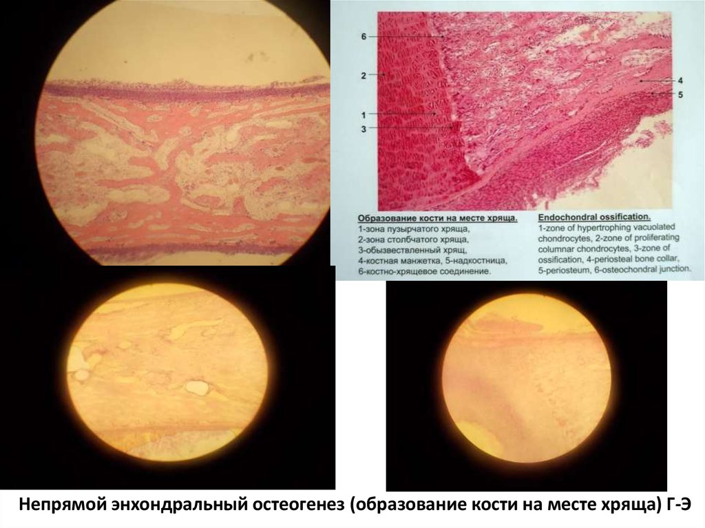 Развитие кости на месте хряща гистология рисунок