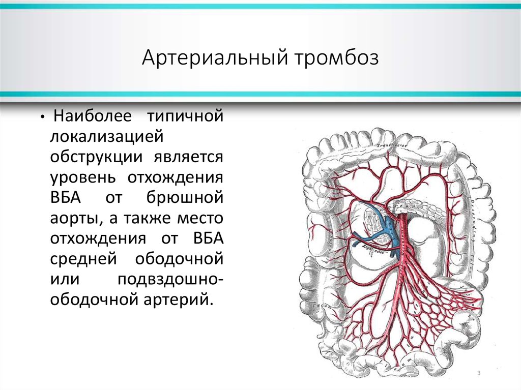 Тромбоз артерий верхних. Мезентериальные сосуды кишечника. Мезентериальный тромбоз клиника. Атеросклероз мезентериальных артерий. Сегменты мезентериального тромбоза.