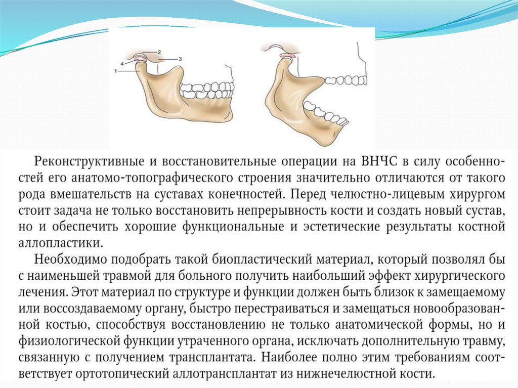 Презентация на тему анкилоз внчс