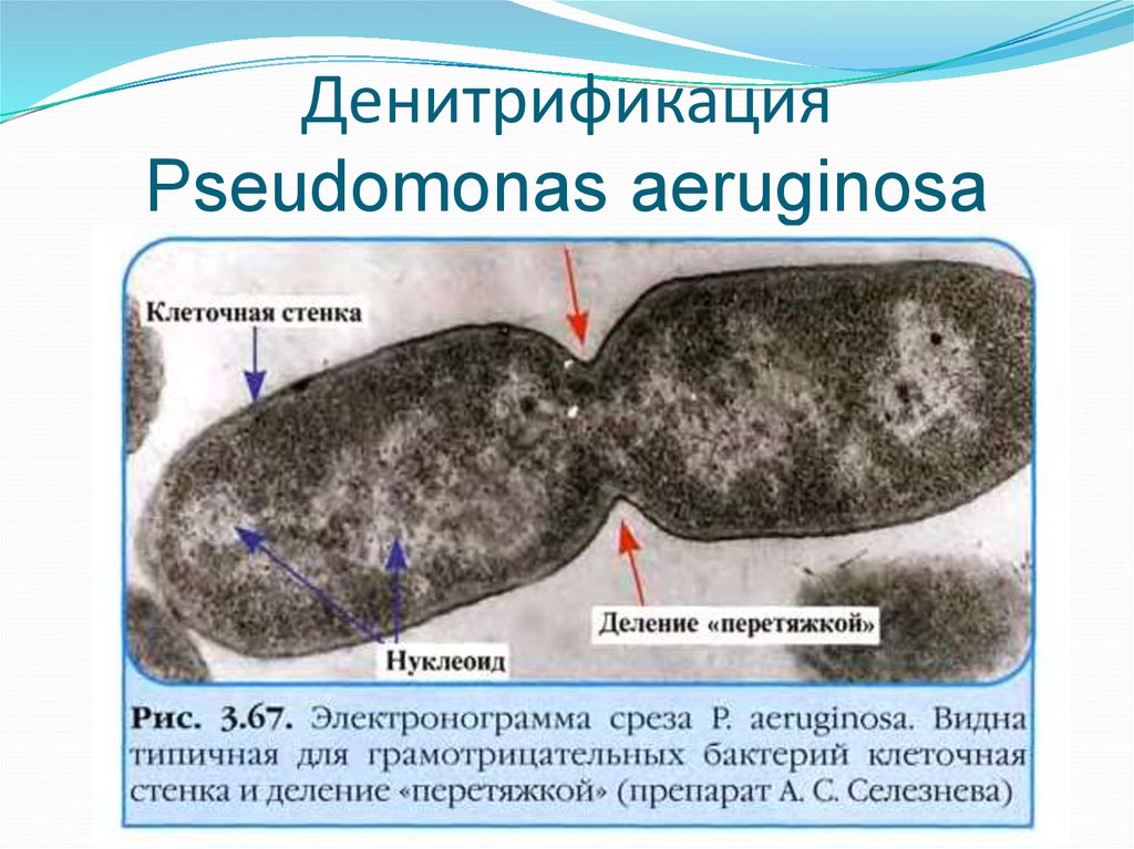 Денитрификация Pseudomonas aeruginosa