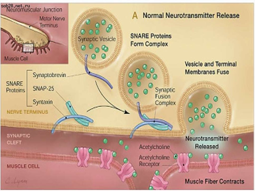 Патогенез ботулизма картинки
