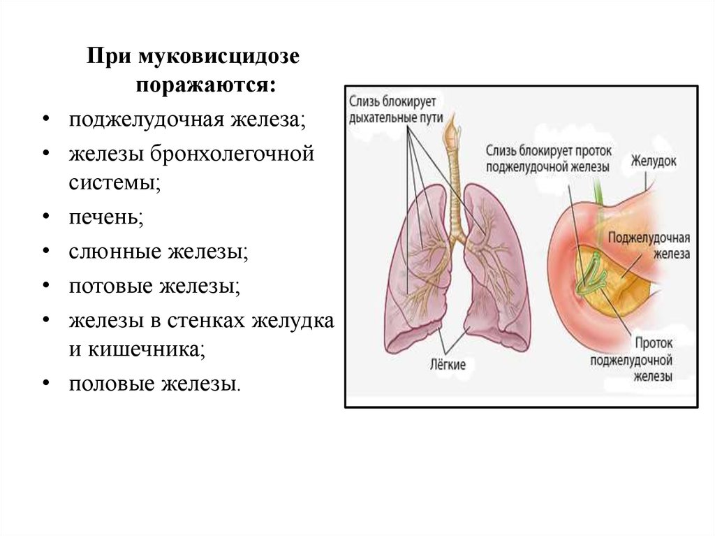 Поджелудочная железа и бронхолегочная система поражается при