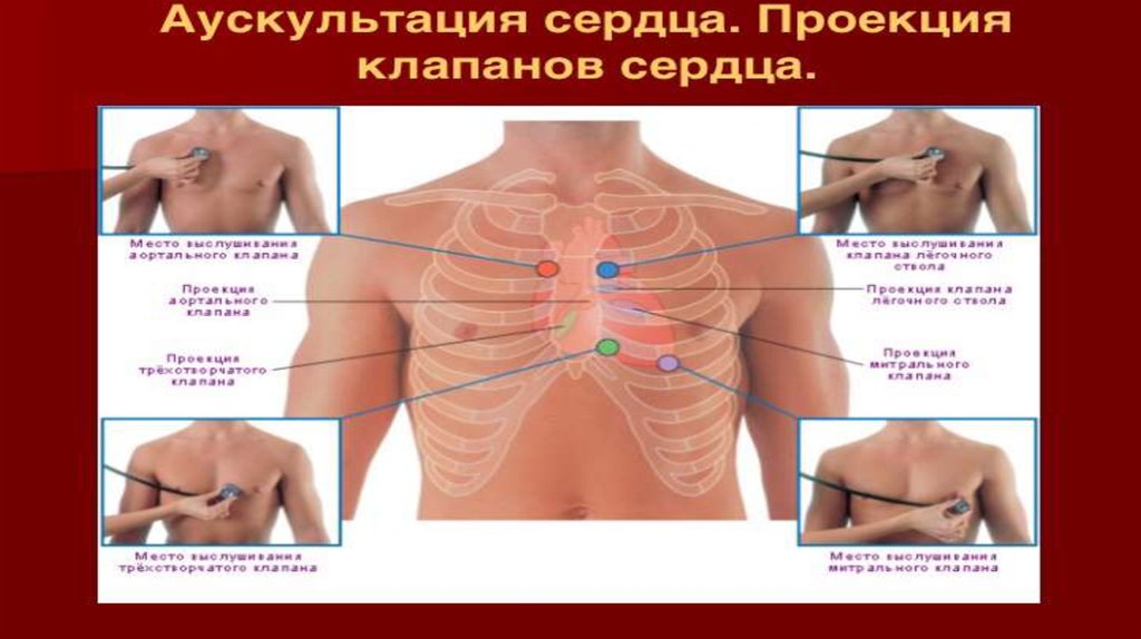 Проекция клапанов сердца. Места проекции клапанов сердца. Места проекции клапанов сердца на грудную клетку. Точки аускультации клапанов сердца. Места выслушивания клапанов сердца.