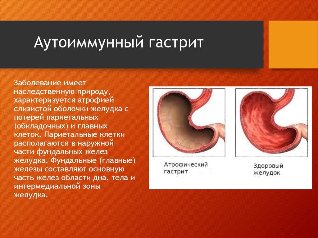 Аутоиммунный гастрит анализы