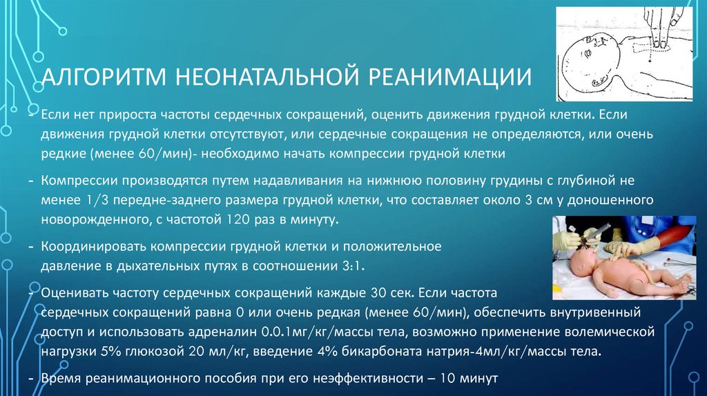 Частота надавливания при компрессии грудной клетки составляет. Реанимация новорожденного алгоритм. Алгоритм реанимации грудному ребенку. Сердечно-легочная реанимация новорожденных алгоритм. Алгоритм сердечно легочной реанимации у новорожденного.