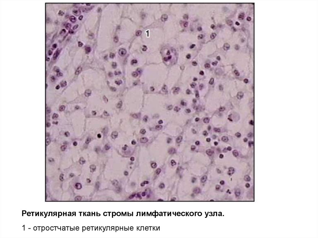 Рисунок ретикулярной ткани