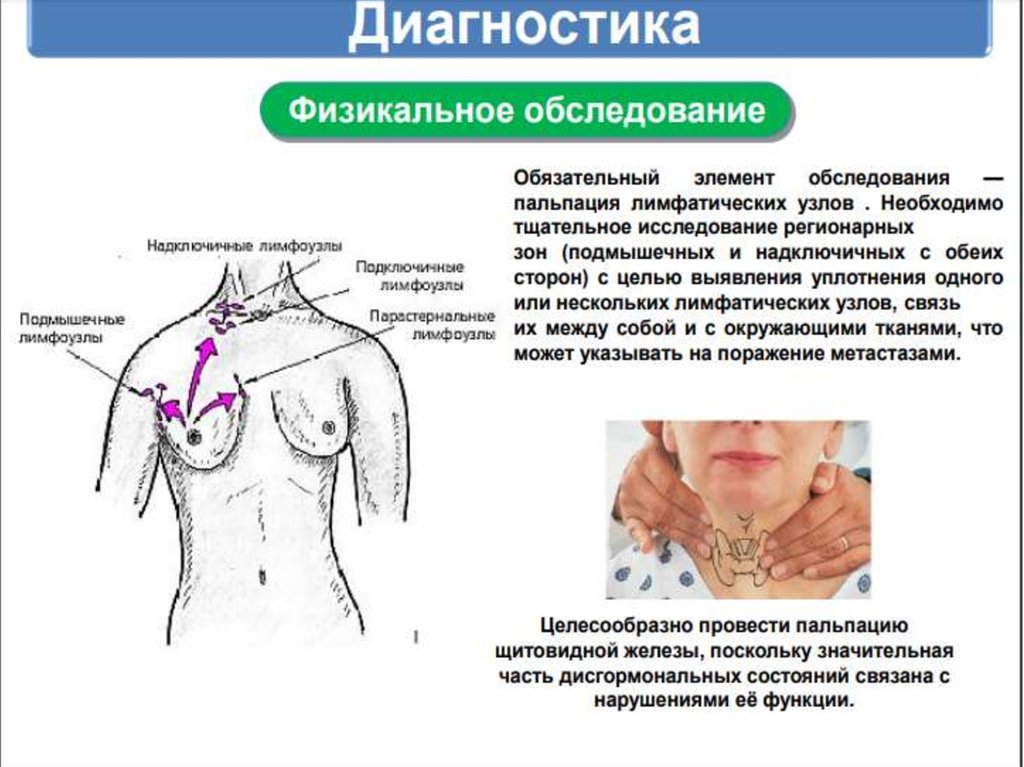Рак молочной железы - презентация онлайн