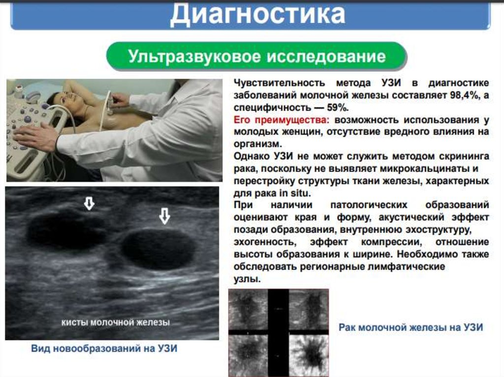 Рак молочной железы - презентация онлайн