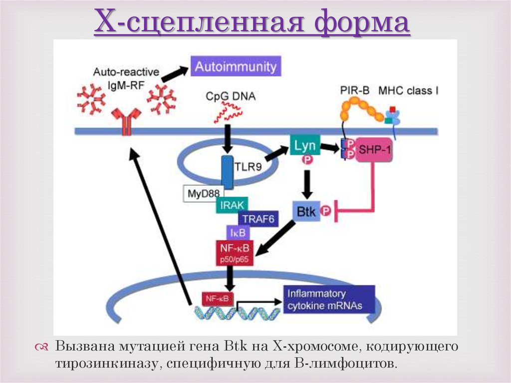 Болезнь брутона сопровождается