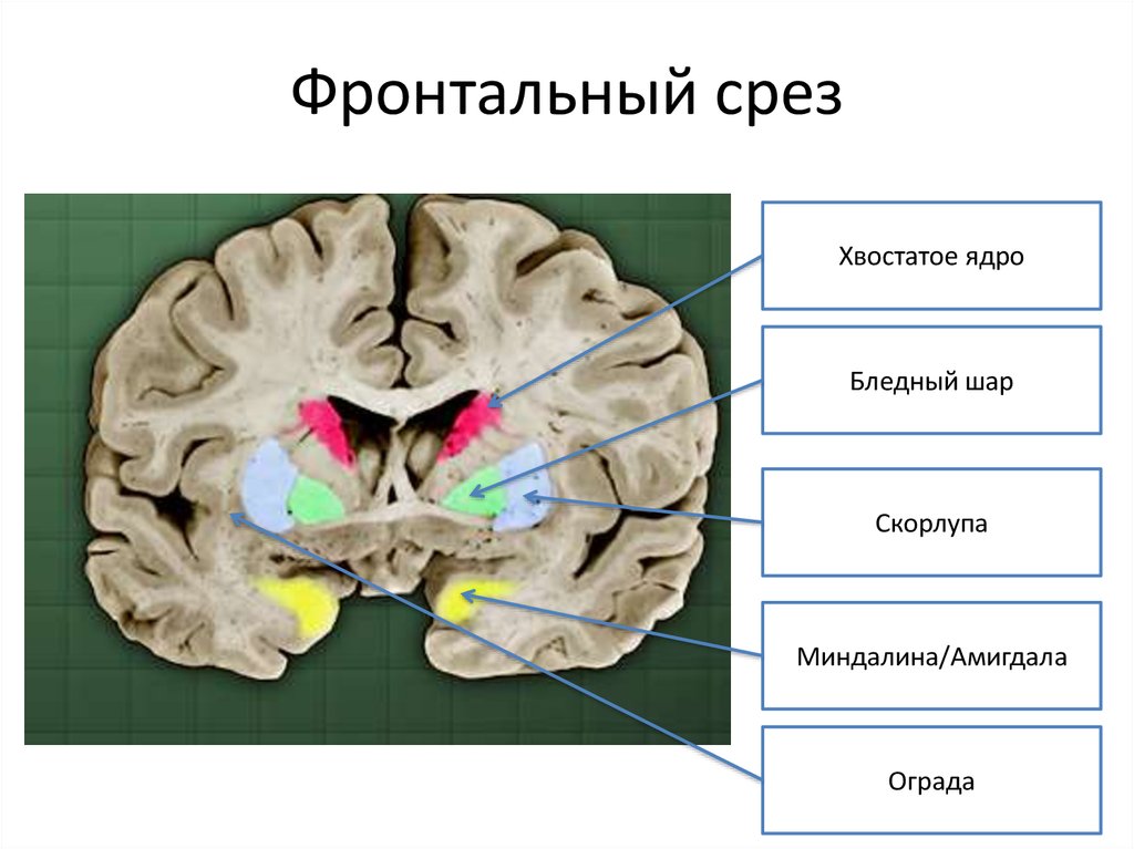 Хвостатое ядро мозга. Головка хвостатого ядра анатомия. Фронтальный срез головного мозга базальные ядра. Головка хвостатого ядра головного мозга. Срез мозга чечевицеобразное ядро.
