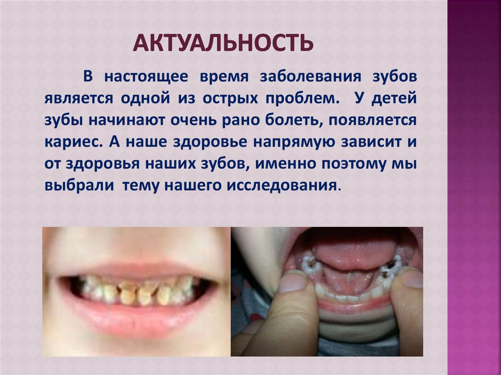 Актуальность