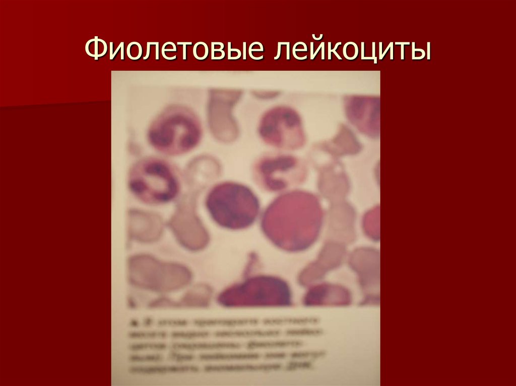 Фиолетовые лейкоциты