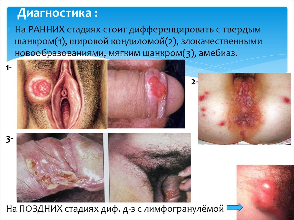 Диагностика :