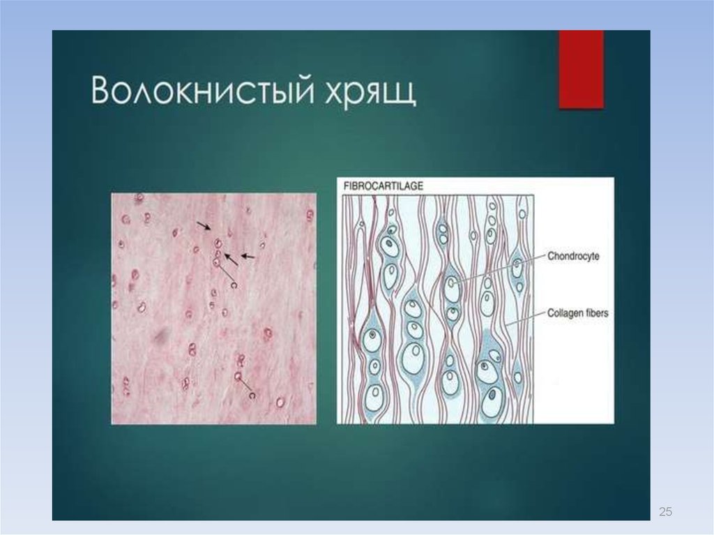 Хрящ. Волокнистый хрящ гистология. Волокнистый хрящ соединительная ткань. Волокнистый хрящ строение. Волокнистый хрящ (межпозвоночный диск) под микроскопом гистология.