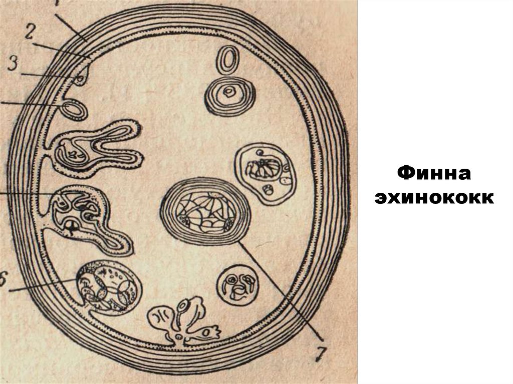 Цифрой обозначено на рисунке яйцо эхинококка. Финна эхинококка строение. Строение финны эхинококка. Строение однокамерного эхинококка.. Эхинококк пузырь строение.